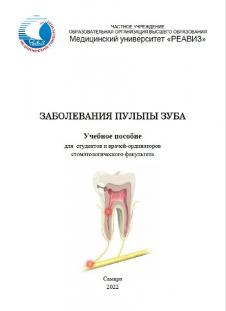 Заболевания пульпы зуба