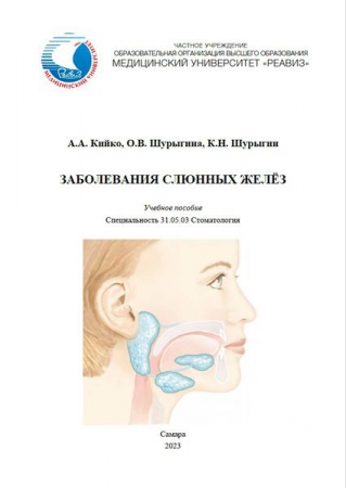 Заболевания слюнных желёз