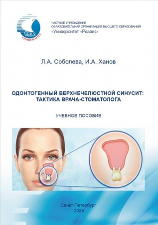 Одонтогенный верхнечелюстной синусит: тактика врача-стоматолога