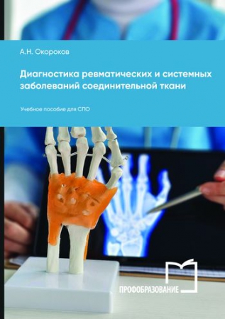 Диагностика ревматических и системных заболеваний соединительной ткани