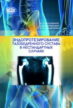 Эндопротезирование тазобедренного сустава в нестандартных случаях Эндопротезирование тазобедренного сустава в нестандартных случаях
